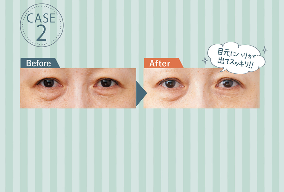 こんなに効果が実感できるなんて驚きです!